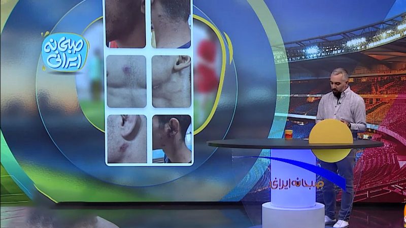 از خداحافظی مسی تا بیماری پوستی در مسابقات کشتی