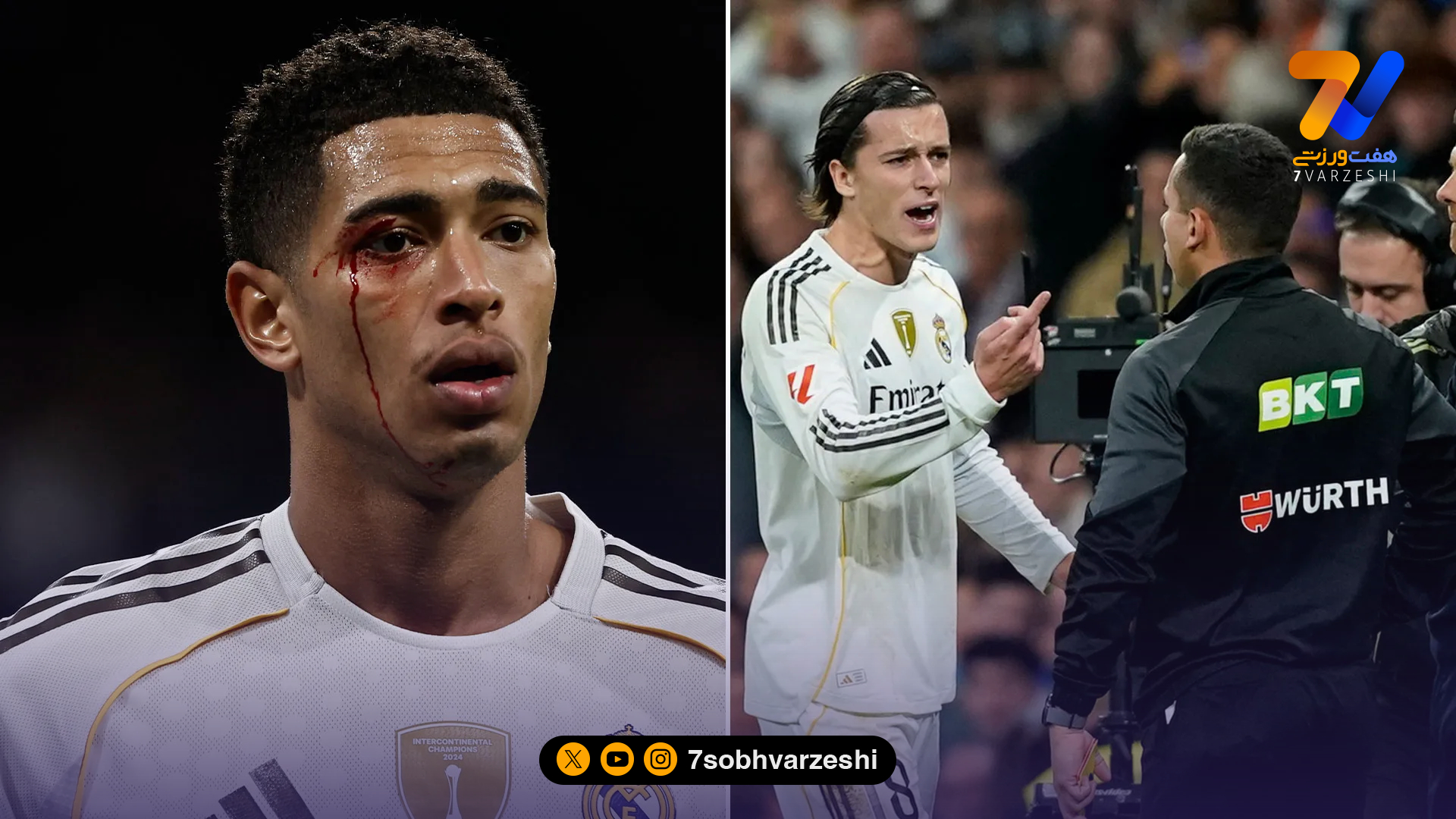 جود بلینگهام خونین و کبود شد؛ جنجال داوری و خشم رئال مادرید