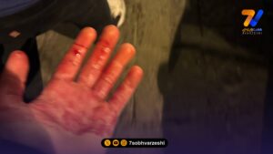 چاقو خوردن هواداران فوتبال در خیابان؛ اتفاق هولناک برای آبی پوشان!
