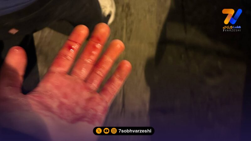 چاقو خوردن هواداران فوتبال در خیابان؛ اتفاق هولناک برای آبی پوشان!