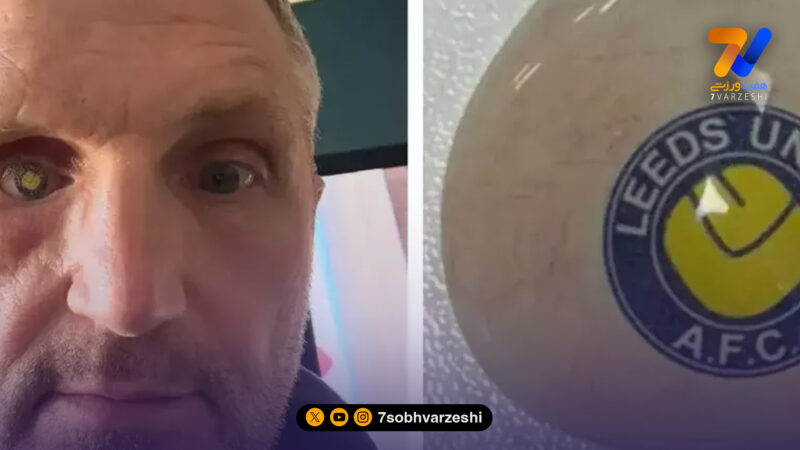 عشق تا ابد به لیدز؛ چشم مصنوعی با نشان باشگاه +عکس