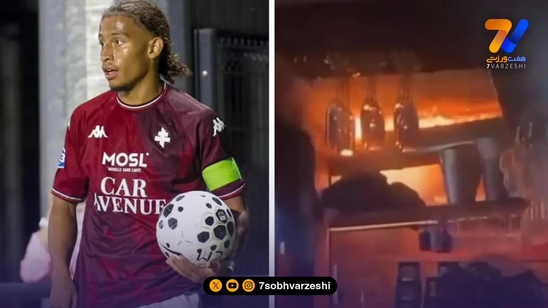 بازیکن فوتبال با سوختگی شدید در بیمارستان بستری شد